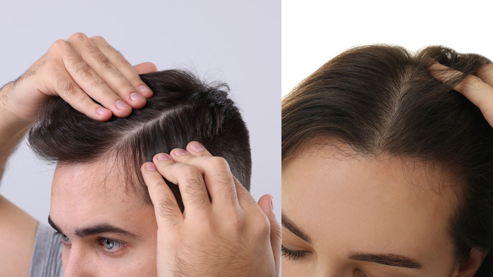 Get advanced treatment for male or female pattern hair loss in Chembur, Mumbai at Alana Skin Hair & Laser Clinic for healthier, thicker hair by Dr. Sweta Sinha.