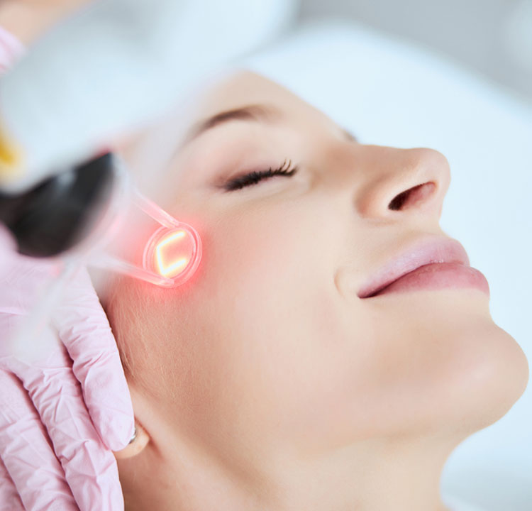 Experience facial lifting with Radio Frequency (RF) Treatment in Mumbai led by Dr. Sweta Sinha for rejuvenated and youthful-looking skin in Tilak Nagar Chembur.